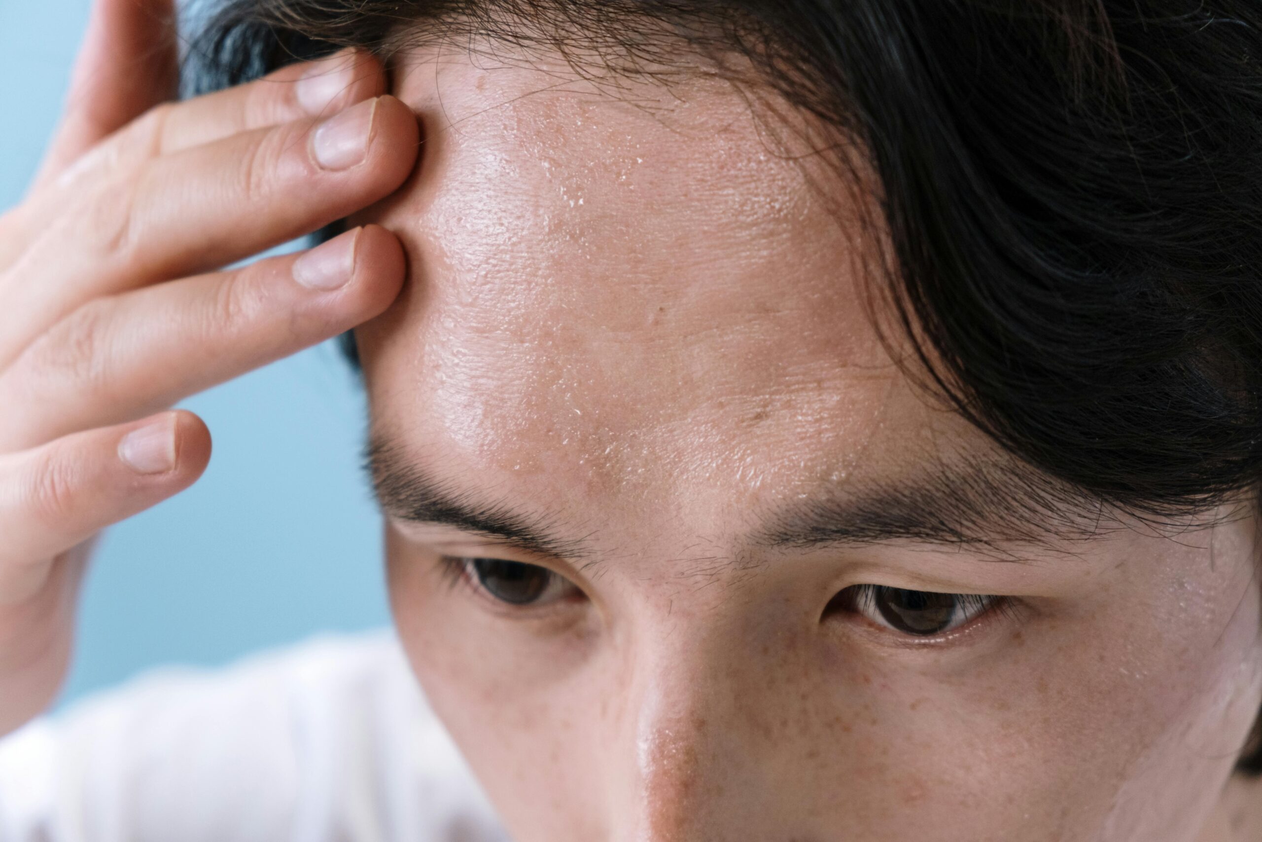 Does sunscreen help prevent dark spots from getting darker?